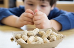 Bambini & Allergie Alimentari