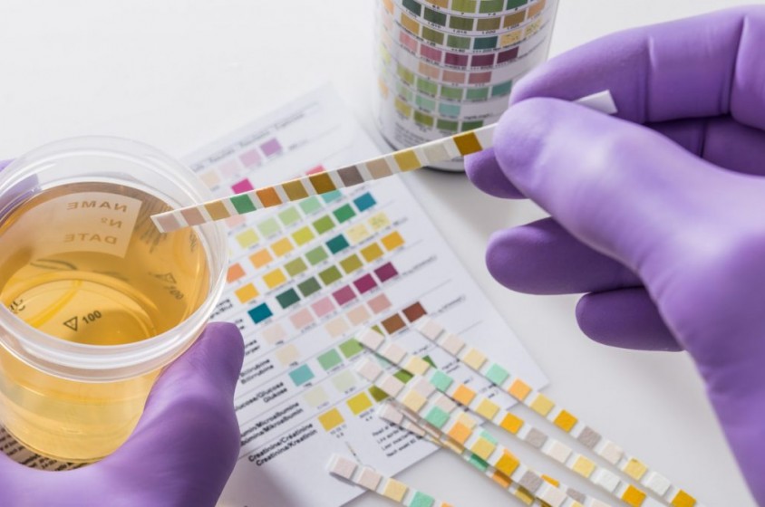 Le urine non mentono 